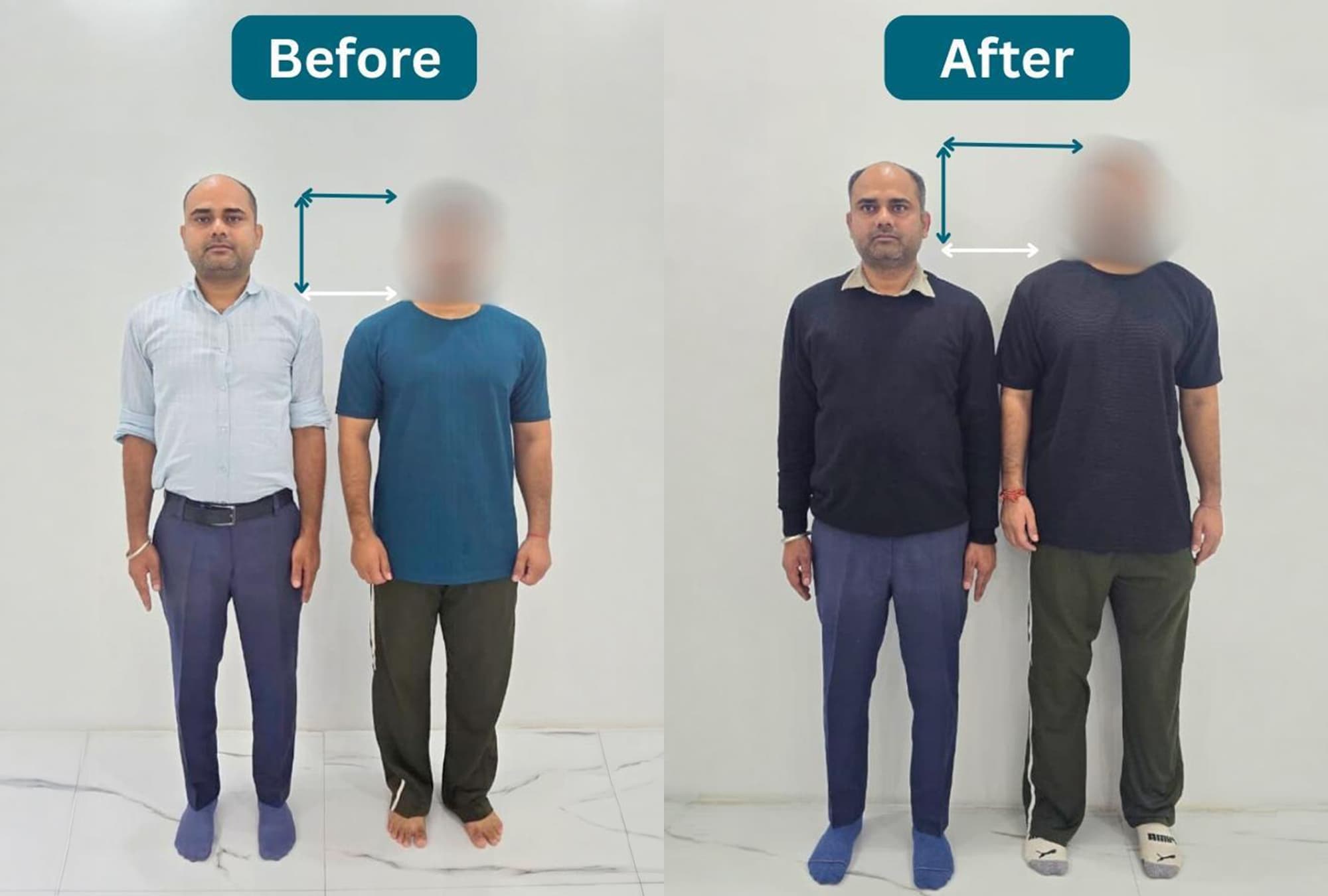 Case Study: Gurpreet Alignment Results