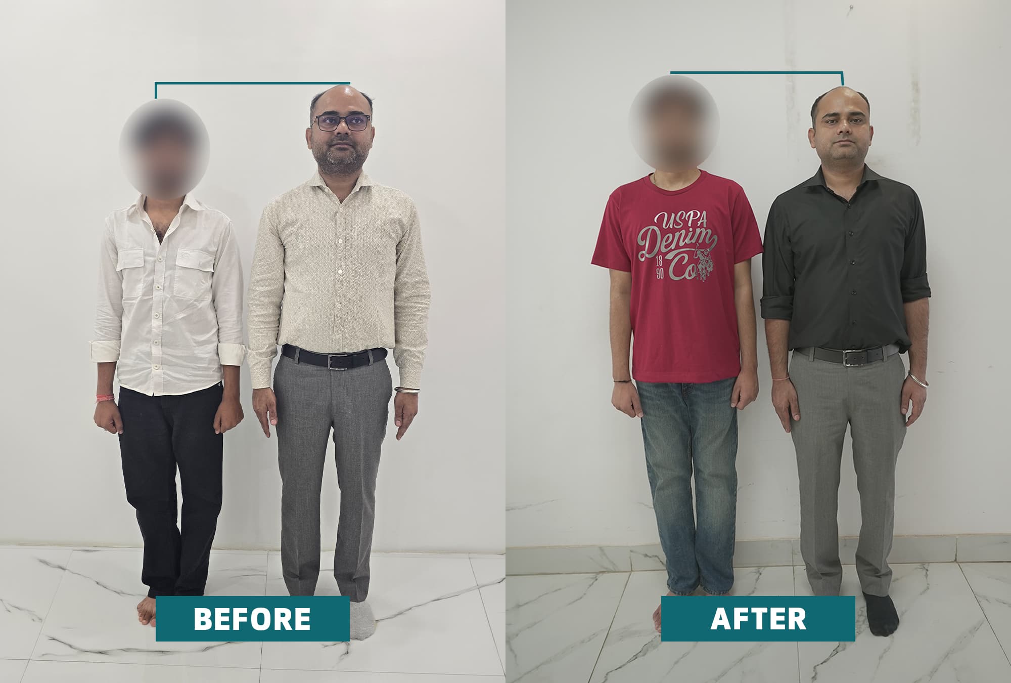 Case Study: Devendar Alignment Results